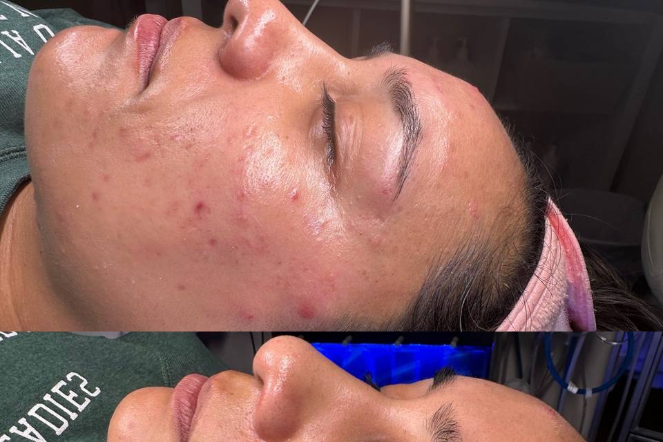 Skin Care Plan