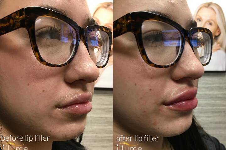 Client before and after