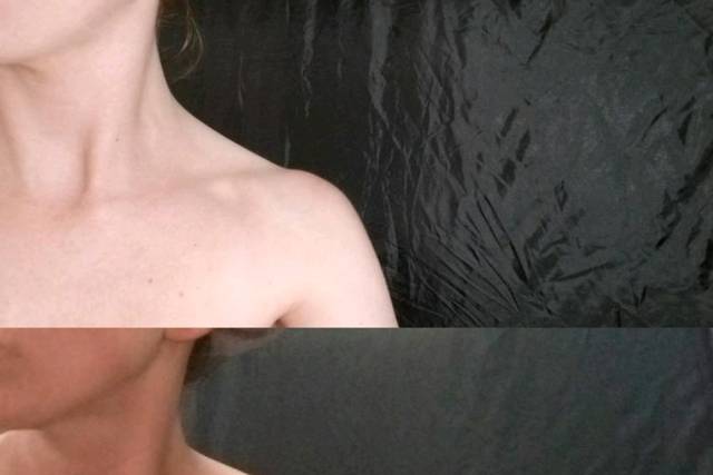 Before and After