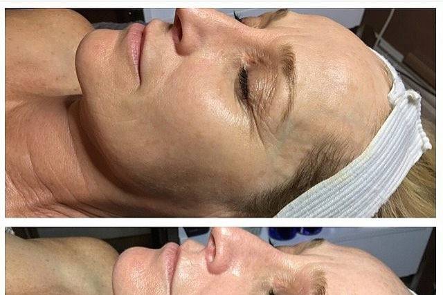 Beautiful skin