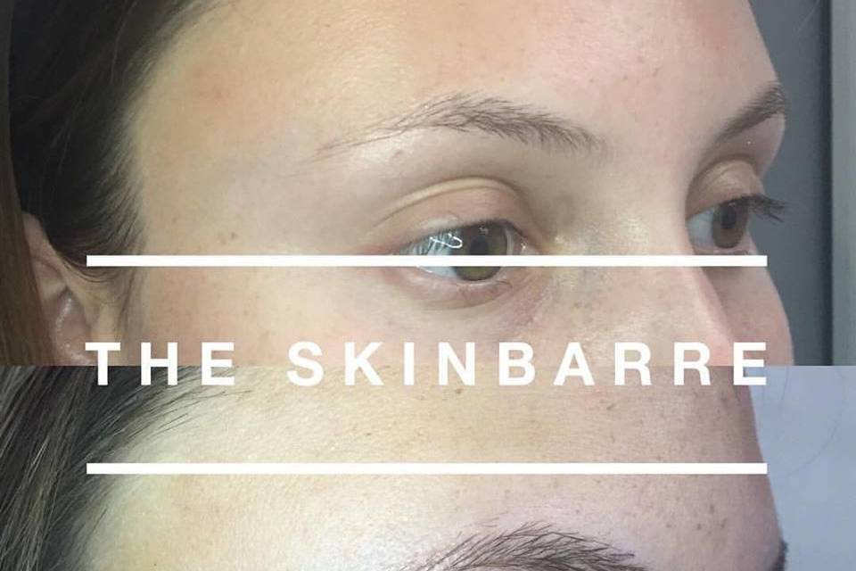 The SkinBarre