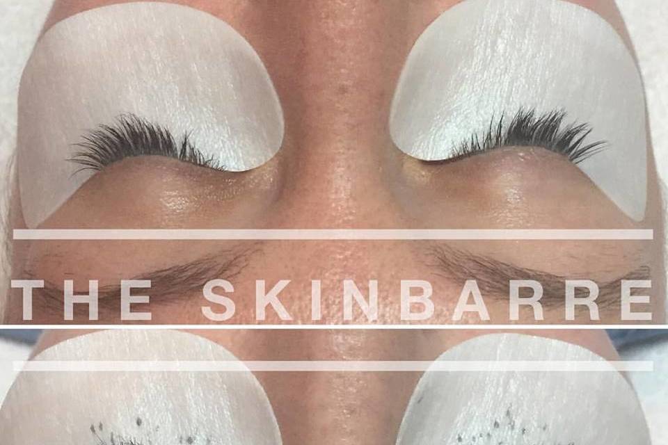The SkinBarre