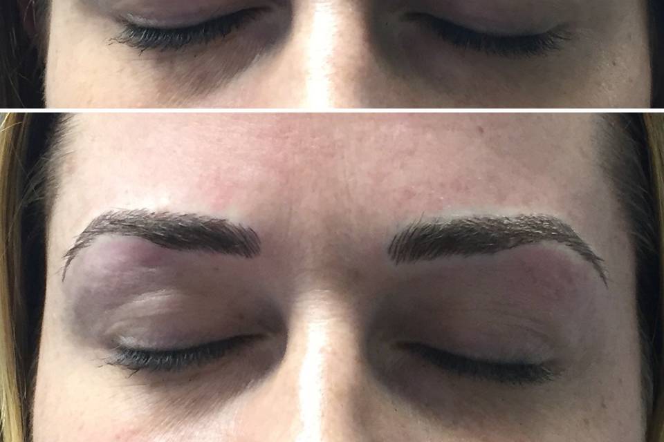 Before and after