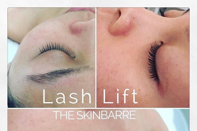 The SkinBarre