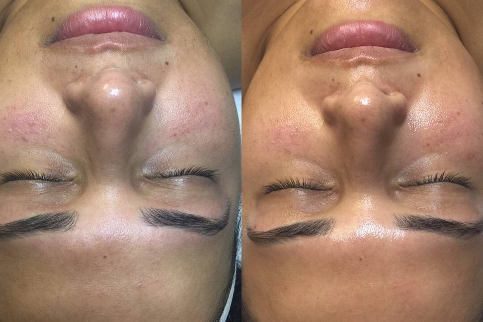 Client