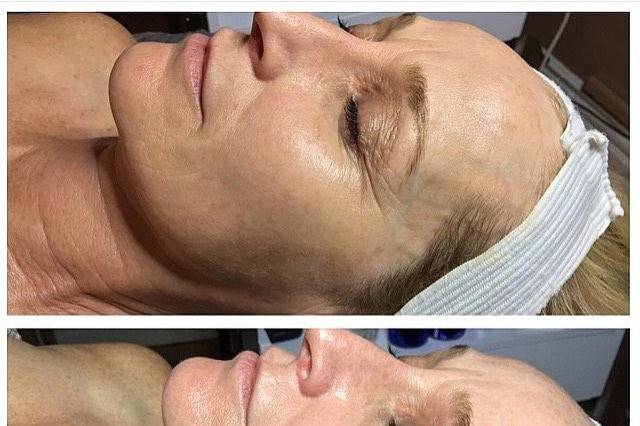 Beautiful skin