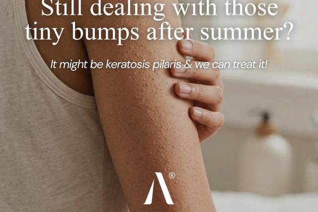 Summer can make keratosis pila