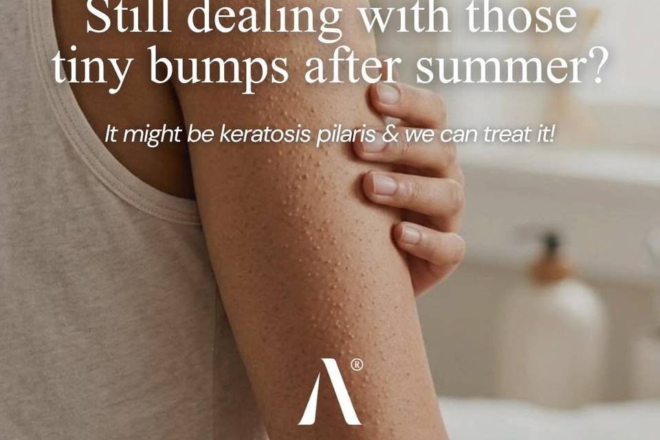 Summer can make keratosis pila