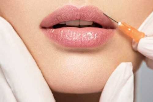 Derma fillers