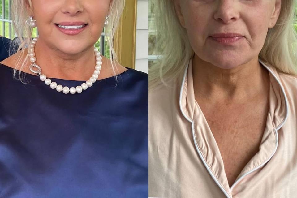 Before after mother of the bri