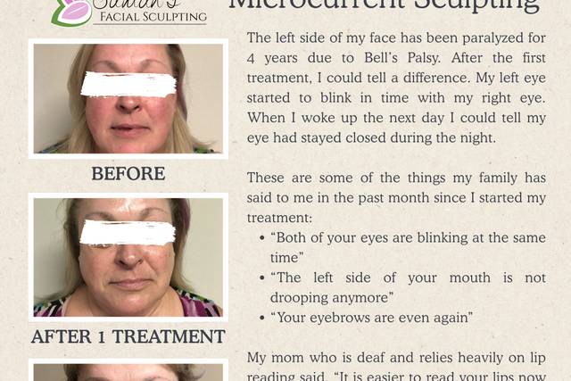 Suman's Facial Sculpting