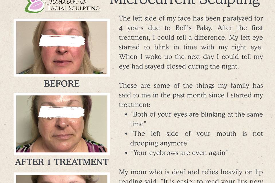 Suman's Facial Sculpting