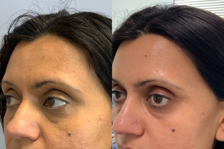 Brow Microblading