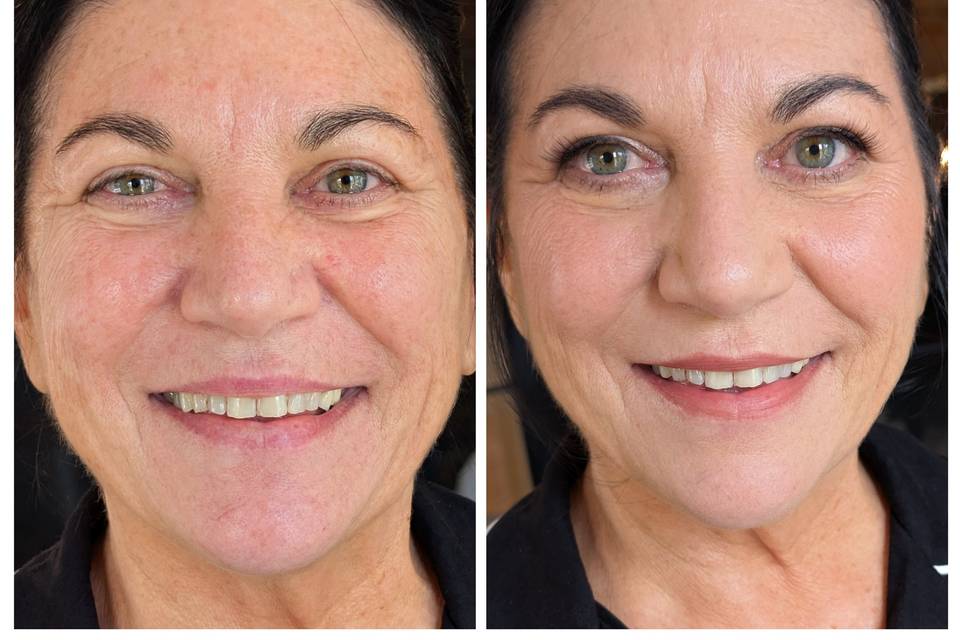 A Beautiful Before and After!