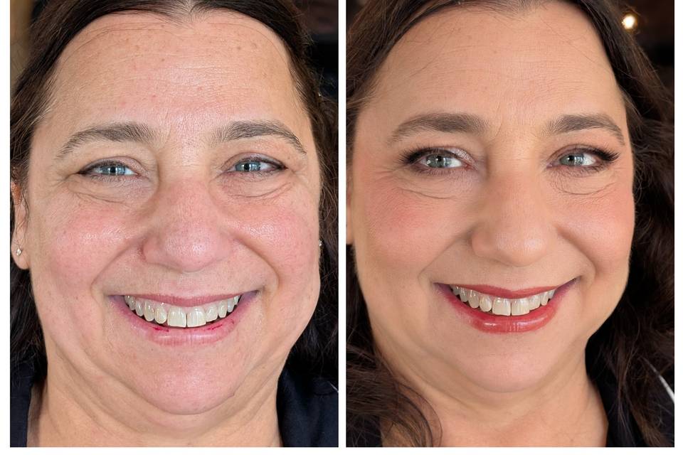 A Beautiful Before and After!