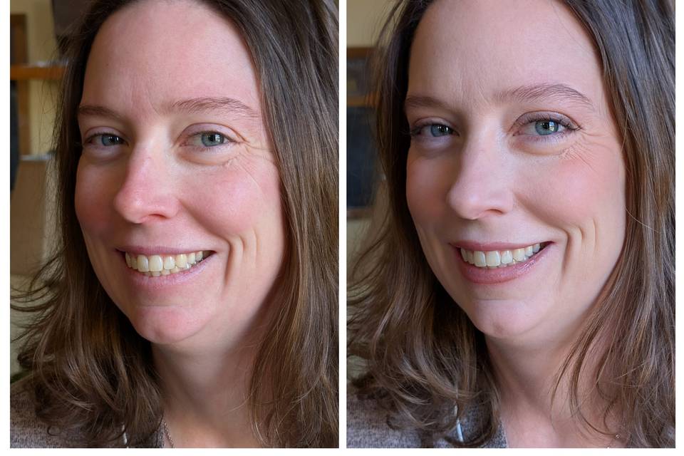 A Beautiful Before and After!