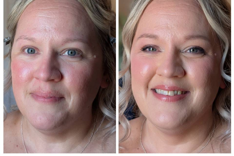A Beautiful Before and After!