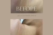Before and after
