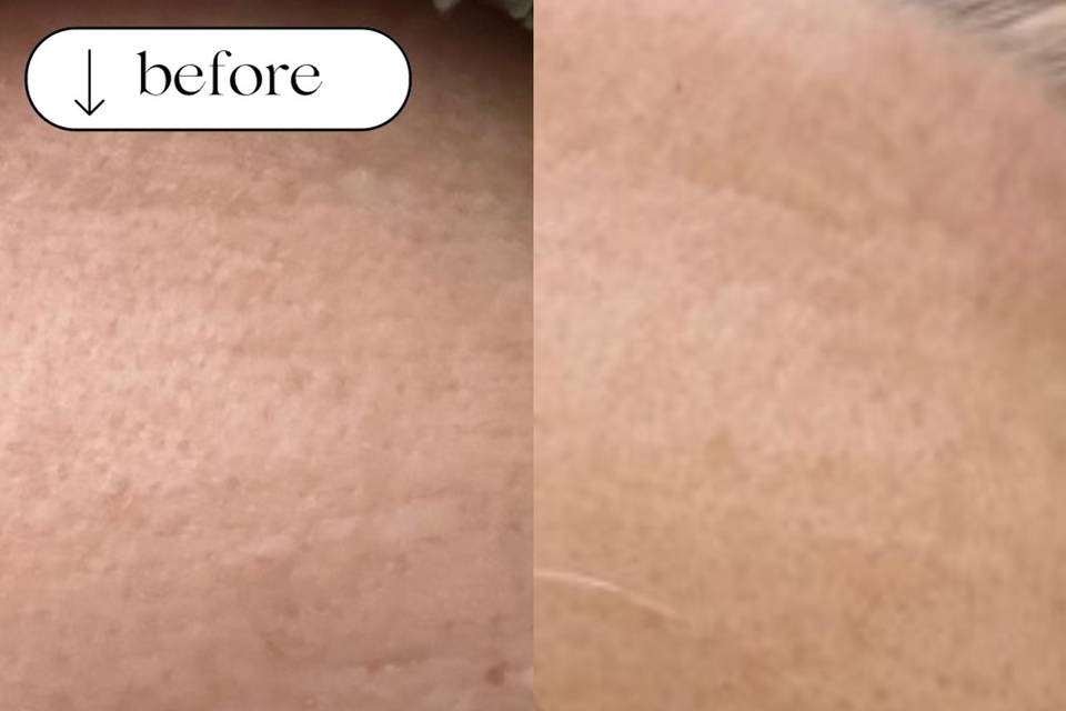 Before after