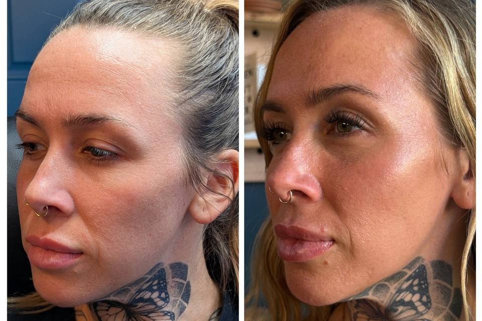 Busy B Injectables