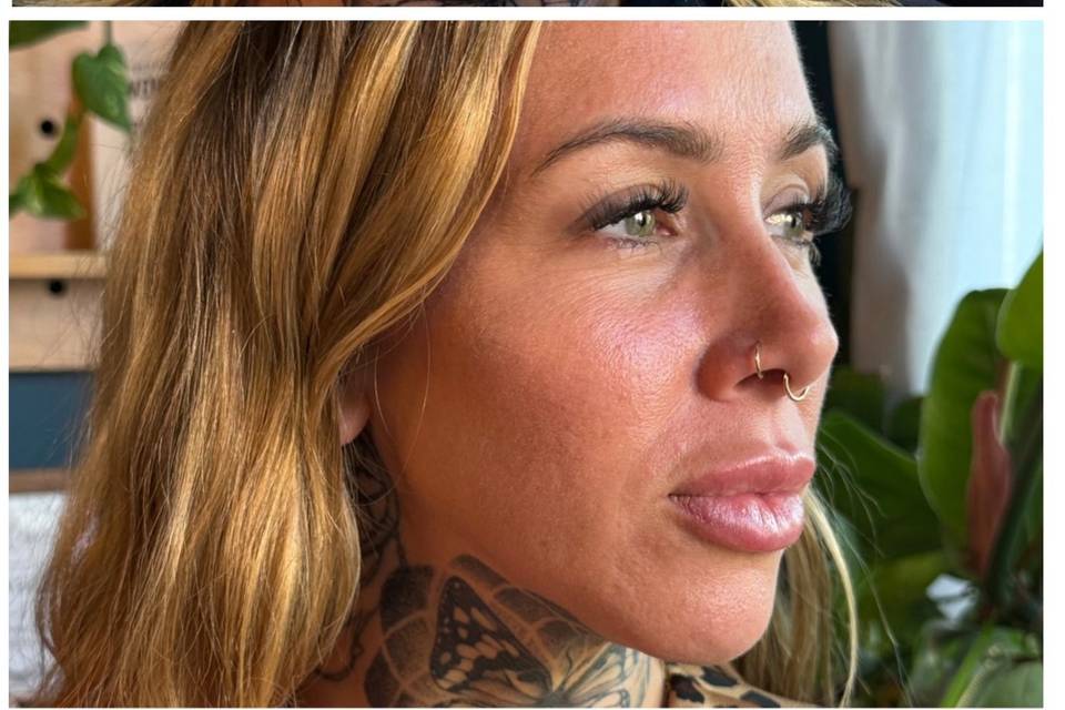 B & A Cheek and Lip Filler