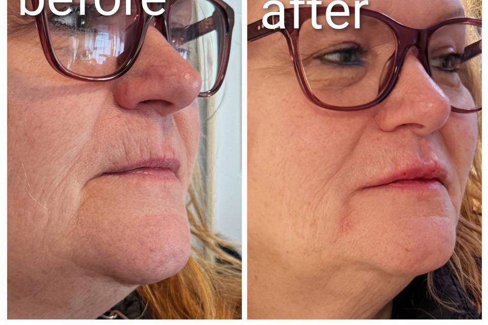Lips and Jowls