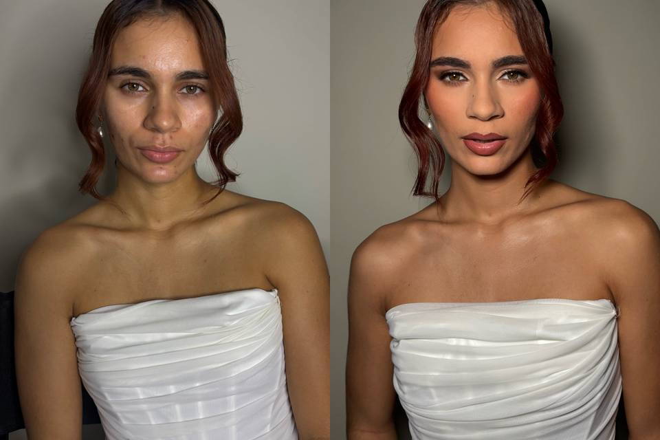 Acne skin makeup