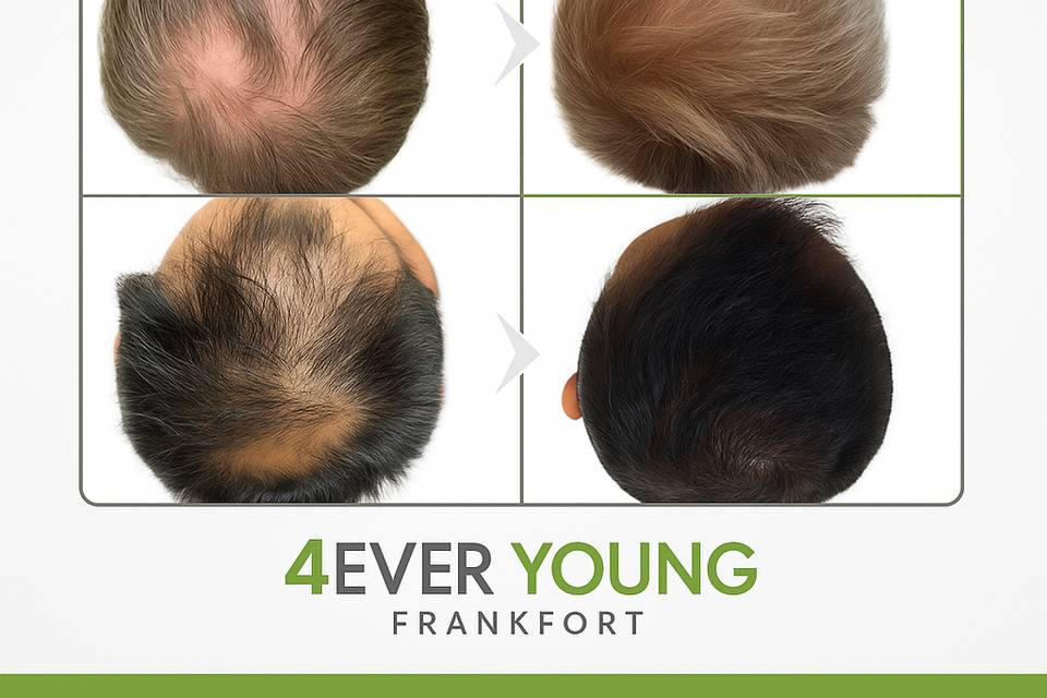 Hair Restoration