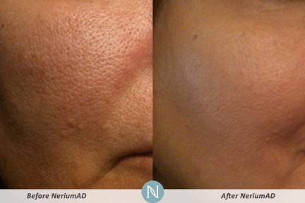 Nerium International