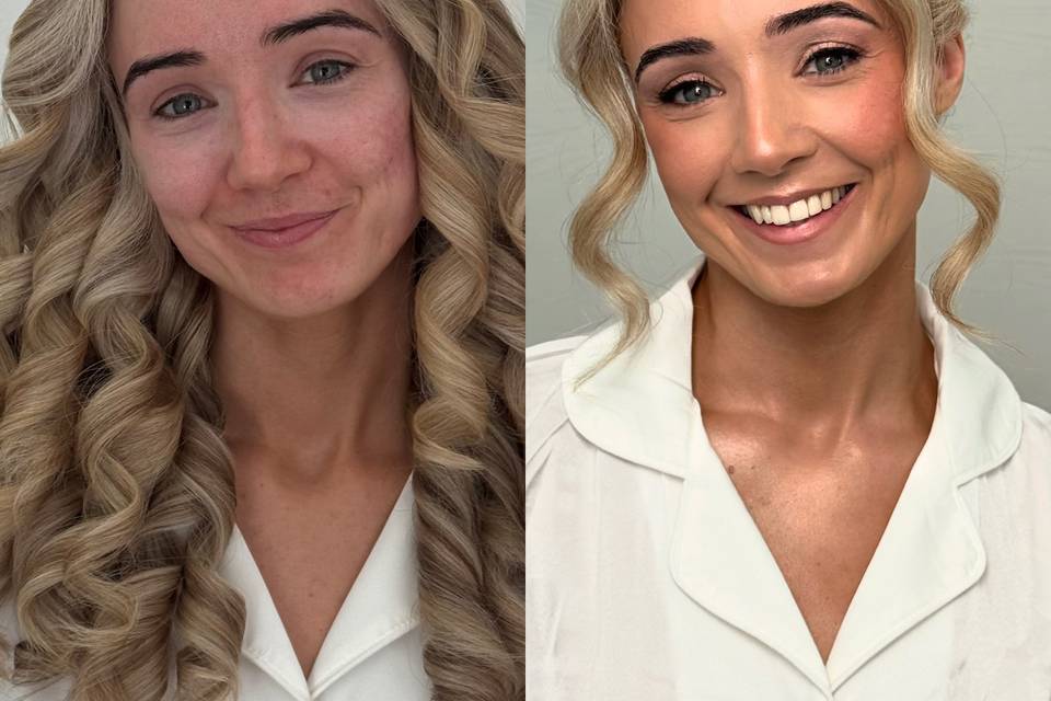 Before/After