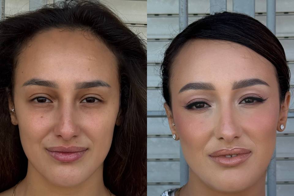 Before/After