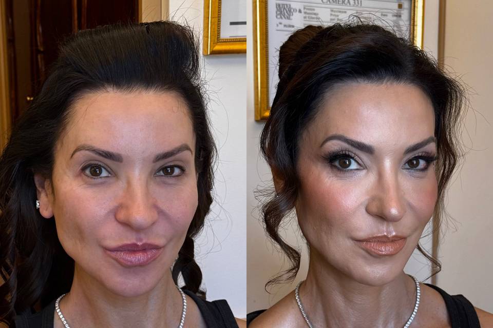 Before and After