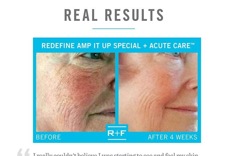 RODAN + FIELDS Skin Solutions by Darci Hiten