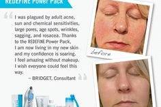 RODAN + FIELDS Skin Solutions by Darci Hiten