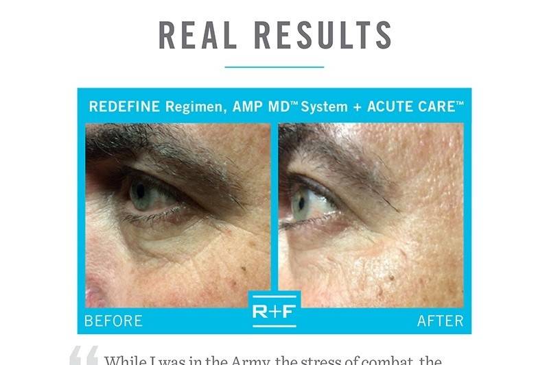 RODAN + FIELDS Skin Solutions by Darci Hiten