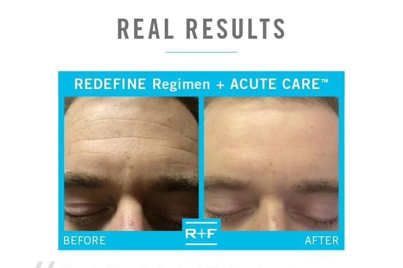 RODAN + FIELDS Skin Solutions by Darci Hiten