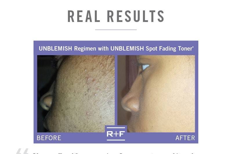 RODAN + FIELDS Skin Solutions by Darci Hiten