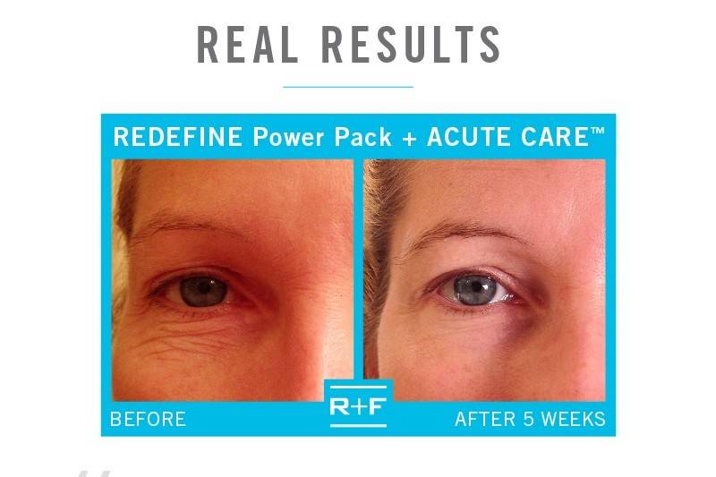 RODAN + FIELDS Skin Solutions by Darci Hiten