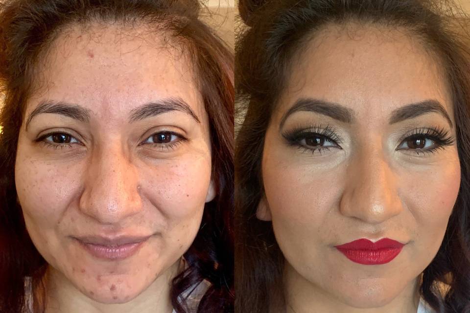 Before and After (Bride)