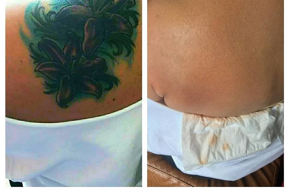 Tattoo Coverup