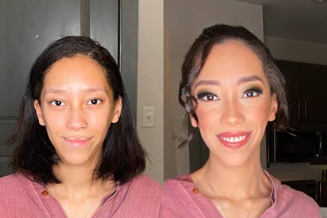 MOH Before & After