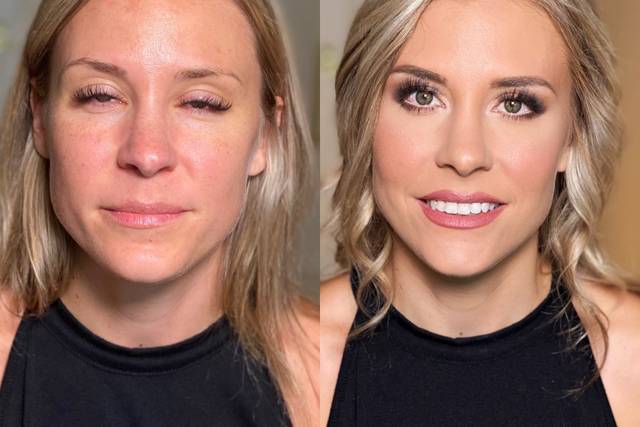 Before and after