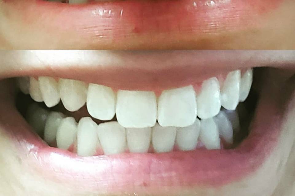 Nice teeth