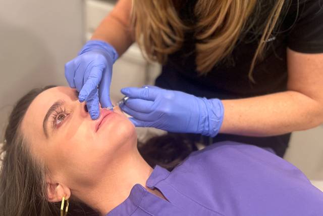 Lip Filler