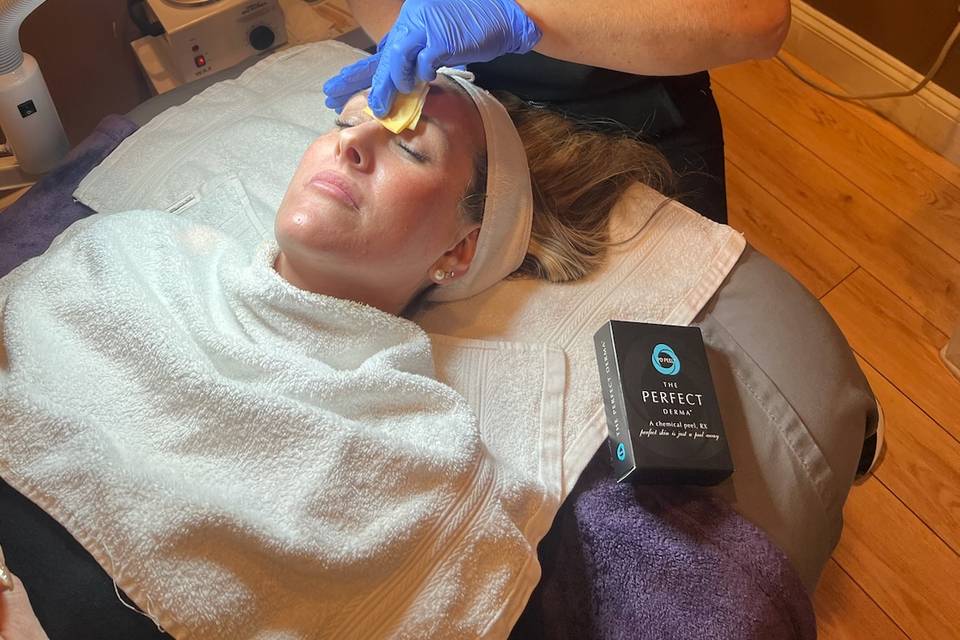 Chemical peel