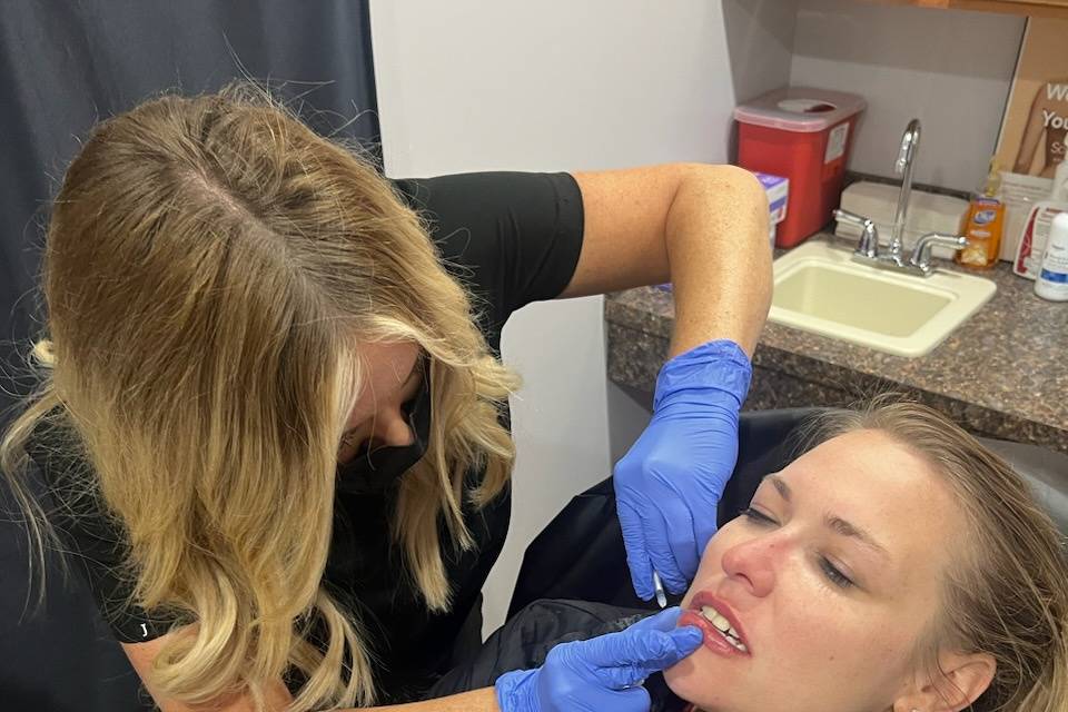 Lip Enhancement