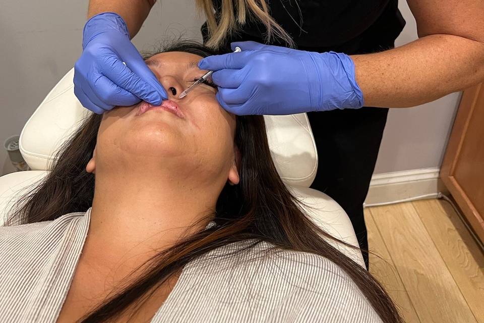 Lip enhancement