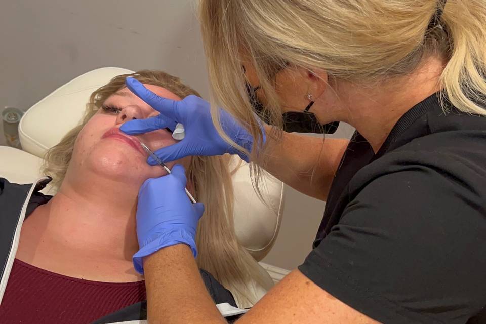 Lip enhancement