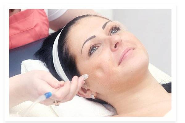 Jet Peel Facial