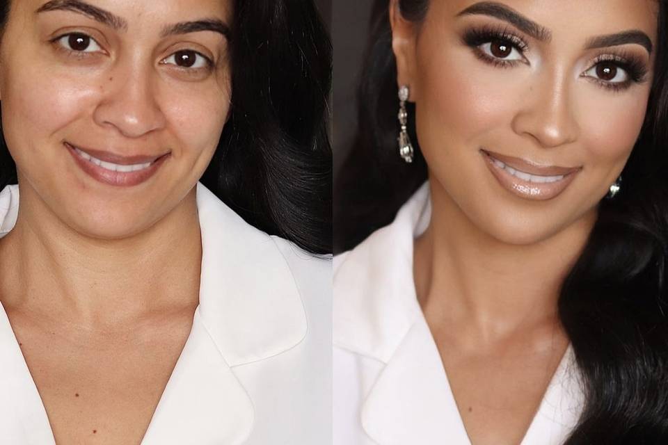 Before&after